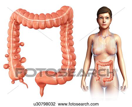 Stock Image - Woman with diverticulosis, illustration. Fotosearch