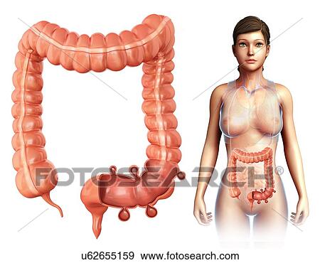 Woman with diverticulosis, illustration View Large Photo Image Stock Photo - Woman with diverticulosis, illustration. Fotosearch