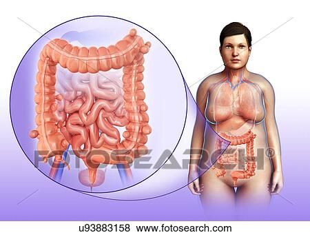 Woman with diverticulosis, illustration View Large Photo Image Stock Photo - Woman with diverticulosis, illustration. Fotosearch
