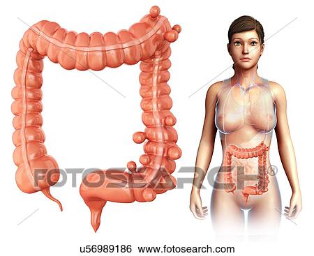 Woman with diverticulosis, illustration View Large Photo Image Stock Photograph - Woman with diverticulosis, illustration. Fotosearch