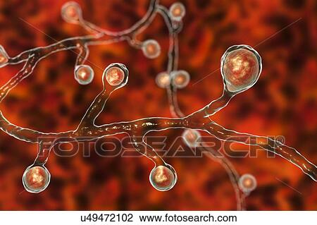 Blastomyces fungus, illustration View Large Photo Image Stock Image - Blastomyces fungus, illustration. Fotosearch