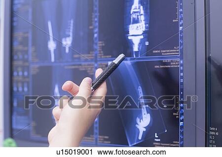 Stock Image - Radiologist studying scans. Fotosearch