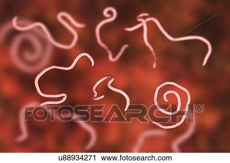 Stock Image - Threadworms, illustration. Fotosearch