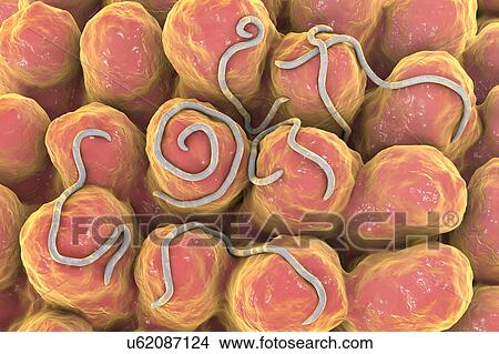 Picture - Threadworms in the gut, illustration. Fotosearch