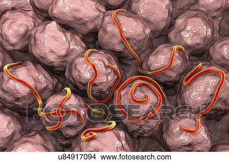 Picture - Threadworms in the gut, illustration. Fotosearch