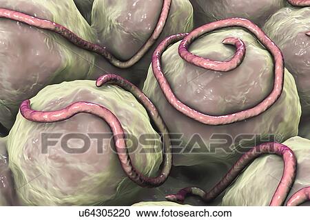 Stock Image - Threadworms in the gut, illustration. Fotosearch