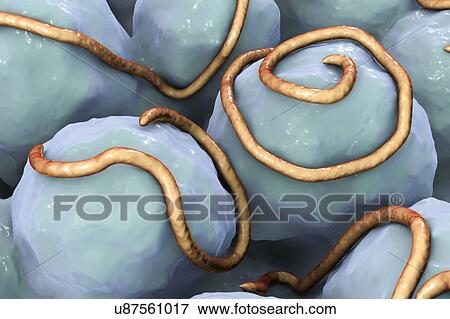Stock Photo - Threadworms in the gut, illustration. Fotosearch