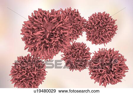 Thyroid cancer cells, illustration View Large Photo Image Stock Photo - Thyroid cancer cells, illustration. Fotosearch