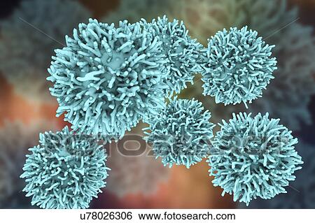Thyroid cancer cells, illustration View Large Photo Image Stock Photograph - Thyroid cancer cells, illustration. Fotosearch