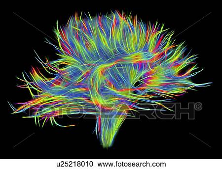 White matter fibres of the human brain, DSI scan View Large Photo Image Stock Image - White matter fibres of the human brain, DSI scan. Fotosearch