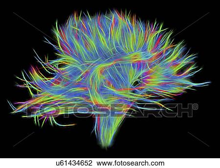 Stock Image - White matter fibres of the human brain, DSI scan. Fotosearch