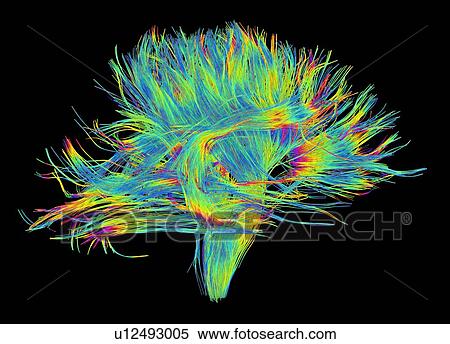 Stock Photography - White matter fibres of the human brain, DSI scan. Fotosearch