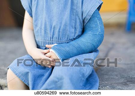 Girl (2-3) with broken arm View Large Photo Image Stock Photo - Girl (2-3) with broken arm. Fotosearch