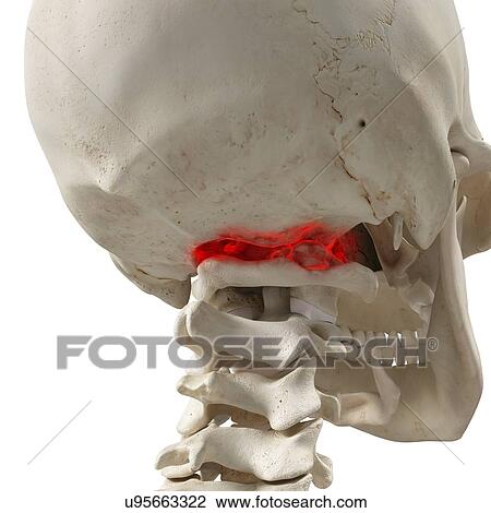 Arthritis in the atlas vertebrae, illustration. View Large Photo Image Stock Image - Arthritis in the atlas vertebrae, illustration.. Fotosearch