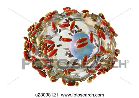 Bacterial vaginosis. Computer illustration of Gardnerella vaginalis bacteria (rods) attached to an epithelial cell, known as a clue cell. G. vaginalis is one of the species of bacteria that cause vaginosis. Clue cells are a diagnostic feature of... View Large Photo Image Stock Image - Bacterial vaginosis. Computer illustration of Gardnerella vaginalis bacteria (rods) attached to an epithelial cell, known as a clue cell. G. vaginalis is one of the species of bacteria that cause vaginosis. Clue cells are a diagnostic feature of.... Fotosearch