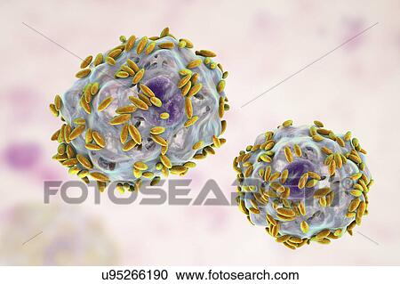 Stock Image - Bacterial vaginosis. Computer illustration of Gardnerella vaginalis bacteria (rods) attached to epithelial cells, known as clue cells. G. vaginalis is one of the species of bacteria that cause vaginosis. Clue cells are a diagnostic feature of.... Fotosearch