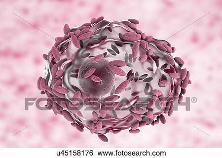 Stock Photograph - Bacterial vaginosis. Computer illustration of Gardnerella vaginalis bacteria (rods) attached to an epithelial cell, known as a clue cell. G. vaginalis is one of the species of bacteria that cause vaginosis. Clue cells are a diagnostic feature of.... Fotosearch