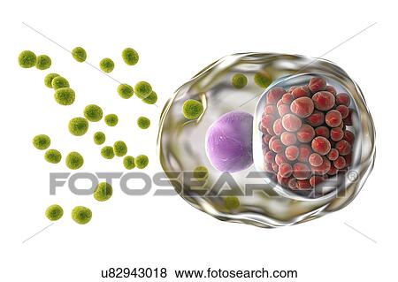 Stock Photo - Chlamydia infection. Computer illustration of a cell infected with Chlamydia trachomatis bacteria. Elementary bodies (EBs, small green spheres), the non-replicating infectious form of the bacteria are seen outside the host cell. EBs infect the cell.... Fotosearch