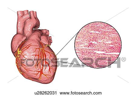 Computer illustration of a human heart and light micrograph of heart muscle. Heart muscle is composed of spindle-shaped cells grouped in irregular bundles. Boundaries between individual cells are faintly visible here. Each cell contains one nucleus,... View Large Photo Image Stock Image - Computer illustration of a human heart and light micrograph of heart muscle. Heart muscle is composed of spindle-shaped cells grouped in irregular bundles. Boundaries between individual cells are faintly visible here. Each cell contains one nucleus,.... Fotosearch