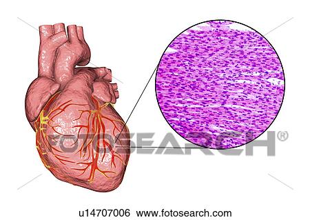 Computer illustration of a human heart and light micrograph of heart muscle. Heart muscle is composed of spindle-shaped cells grouped in irregular bundles. Boundaries between individual cells are faintly visible here. Each cell contains one nucleus,... View Large Photo Image Stock Photograph - Computer illustration of a human heart and light micrograph of heart muscle. Heart muscle is composed of spindle-shaped cells grouped in irregular bundles. Boundaries between individual cells are faintly visible here. Each cell contains one nucleus,.... Fotosearch