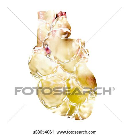 Fatty heart. Conceptual illustration showing a heart made of fat cells. View Large Photo Image Stock Image - Fatty heart. Conceptual illustration showing a heart made of fat cells.. Fotosearch