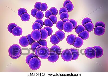 Gonorrhoeae bacteria. Computer illustration of Neisseria gonorrhoeae bacteria. N. gonorrhoeae is a Gram-negative bacterium that causes the sexually transmitted infection gonorrhoea. Symptoms include vaginal or urethral discharge and a burning... View Large Photo Image Stock Image - Gonorrhoeae bacteria. Computer illustration of Neisseria gonorrhoeae bacteria. N. gonorrhoeae is a Gram-negative bacterium that causes the sexually transmitted infection gonorrhoea. Symptoms include vaginal or urethral discharge and a burning.... Fotosearch