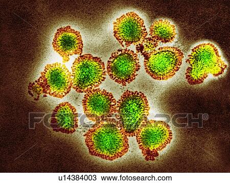 H3N2 influenza virus particles, coloured transmission electron micrograph (TEM). Each virus consists of a nucleocapsid (protein coat) that surrounds a core of RNA (ribonucleic acid) genetic material. Surrounding the nucleocapsid is a lipid envelope... View Large Photo Image Stock Image - H3N2 influenza virus particles, coloured transmission electron micrograph (TEM). Each virus consists of a nucleocapsid (protein coat) that surrounds a core of RNA (ribonucleic acid) genetic material. Surrounding the nucleocapsid is a lipid envelope.... Fotosearch