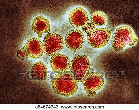 H3N2 influenza virus particles, coloured transmission electron micrograph (TEM). Each virus consists of a nucleocapsid (protein coat) that surrounds a core of RNA (ribonucleic acid) genetic material. Surrounding the nucleocapsid is a lipid envelope... View Large Photo Image Stock Image - H3N2 influenza virus particles, coloured transmission electron micrograph (TEM). Each virus consists of a nucleocapsid (protein coat) that surrounds a core of RNA (ribonucleic acid) genetic material. Surrounding the nucleocapsid is a lipid envelope.... Fotosearch