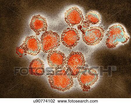 H3N2 influenza virus particles, coloured transmission electron micrograph (TEM). Each virus consists of a nucleocapsid (protein coat) that surrounds a core of RNA (ribonucleic acid) genetic material. Surrounding the nucleocapsid is a lipid envelope... View Large Photo Image Stock Image - H3N2 influenza virus particles, coloured transmission electron micrograph (TEM). Each virus consists of a nucleocapsid (protein coat) that surrounds a core of RNA (ribonucleic acid) genetic material. Surrounding the nucleocapsid is a lipid envelope.... Fotosearch