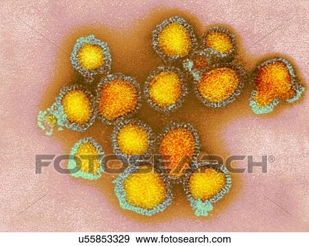 Stock Photo - H3N2 influenza virus particles, coloured transmission electron micrograph (TEM). Each virus consists of a nucleocapsid (protein coat) that surrounds a core of RNA (ribonucleic acid) genetic material. Surrounding the nucleocapsid is a lipid envelope.... Fotosearch