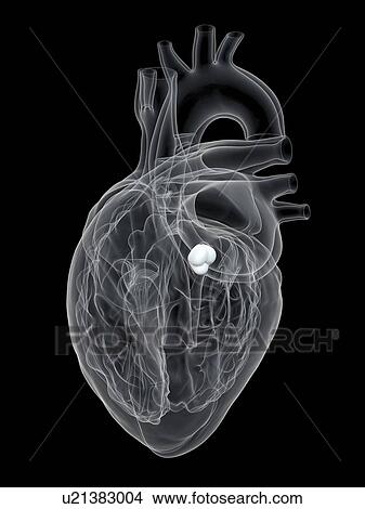 Human heart showing the aortic valve, illustration. View Large Photo Image Picture - Human heart showing the aortic valve, illustration.. Fotosearch
