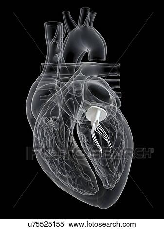 Human heart showing the mitral valve, illustration. View Large Photo Image Stock Photography - Human heart showing the mitral valve, illustration.. Fotosearch