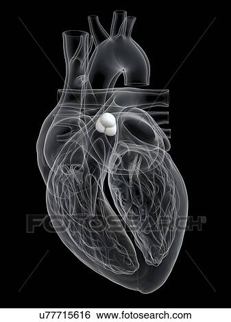 Human heart showing the pulmonary valve, illustration. View Large Photo Image Stock Photograph - Human heart showing the pulmonary valve, illustration.. Fotosearch