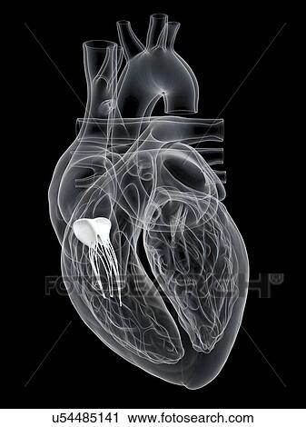 Human heart showing the tricuspid valve, illustration. View Large Photo Image Stock Image - Human heart showing the tricuspid valve, illustration.. Fotosearch