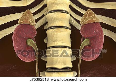Stock Image - Human kidneys and adrenal glands, illustration. Fotosearch