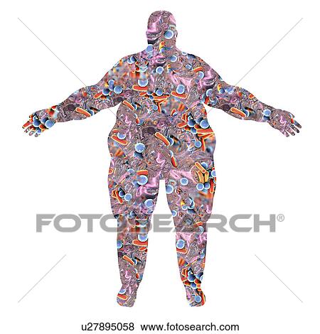 Stock Photo - Human microbiome in obese person, illustration. Fotosearch