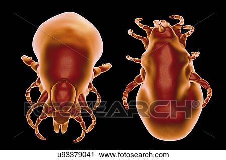 Stock Image - Lyme disease tick, illustration. Fotosearch
