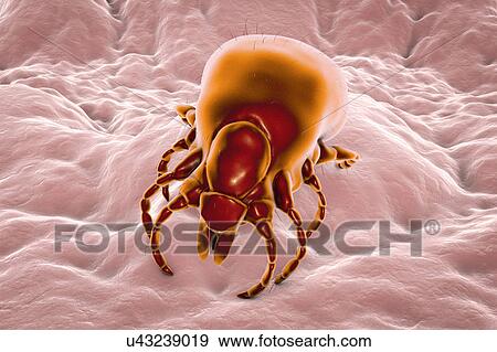 Stock Photo - Lyme disease tick, illustration. Fotosearch