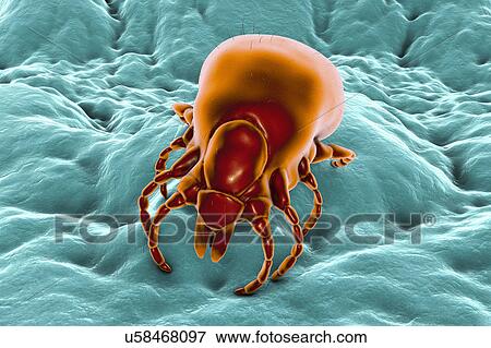 Lyme disease tick, illustration View Large Photo Image Stock Photo - Lyme disease tick, illustration. Fotosearch