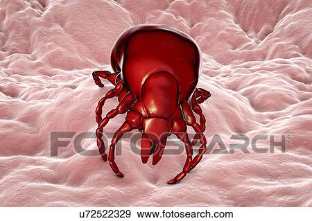Lyme disease tick, illustration View Large Photo Image Stock Photo - Lyme disease tick, illustration. Fotosearch