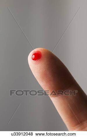 Stock Photo - MODEL RELEASED. Blood on fingertip, close up.. Fotosearch