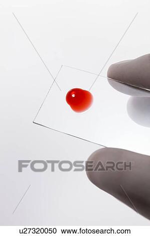 MODEL RELEASED. Blood sample on microscope slide, studio shot. View Large Photo Image Stock Image - MODEL RELEASED. Blood sample on microscope slide, studio shot.. Fotosearch