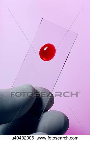 MODEL RELEASED. Blood sample on microscope slide, studio shot. View Large Photo Image Stock Photograph - MODEL RELEASED. Blood sample on microscope slide, studio shot.. Fotosearch