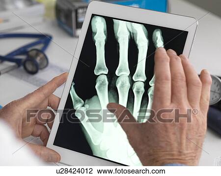 Stock Image - MODEL RELEASED. Doctor viewing an X-ray of a hand on a digital tablet.. Fotosearch
