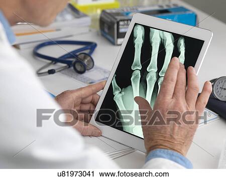 MODEL RELEASED. Doctor viewing an X-ray of a hand on a digital tablet. View Large Photo Image Stock Image - MODEL RELEASED. Doctor viewing an X-ray of a hand on a digital tablet.. Fotosearch