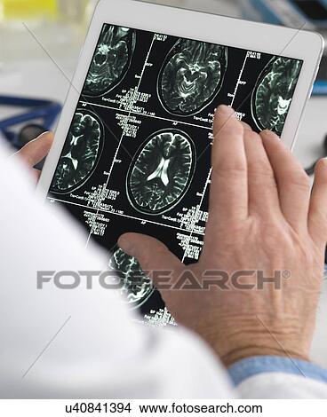 MODEL RELEASED. Doctor viewing brain scans on a digital tablet. View Large Photo Image Picture - MODEL RELEASED. Doctor viewing brain scans on a digital tablet.. Fotosearch
