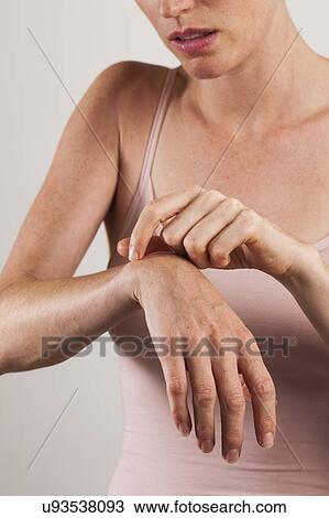 Stock Image - MODEL RELEASED. Woman scratching itchy arm.. Fotosearch