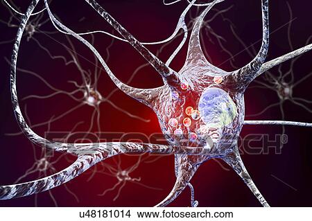 Picture - Parkinson's disease nerve cells. Computer illustration of human nerve cells affected by Lewy bodies (small red spheres inside cytoplasm of neurons) in the brain of a patient with Parkinson's disease. Lewy bodies are abnormal accumulations of protein.... Fotosearch
