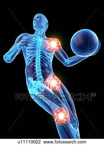 Stock Image - Person playing basketball showing joints, illustration.. Fotosearch