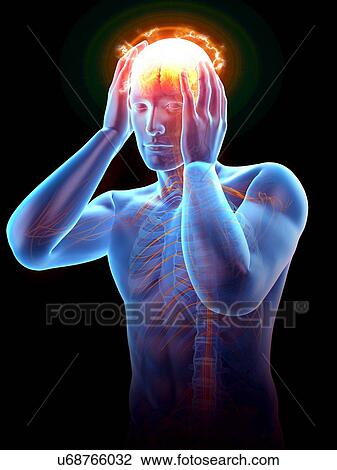 Stock Image - Person with headache, illustration.. Fotosearch